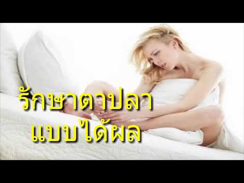 ยาพื้นบ้านสำหรับโรคสะเก็ดเงินในร่างกาย ไม่ shot ไข้หวัดสำหรับกลาก