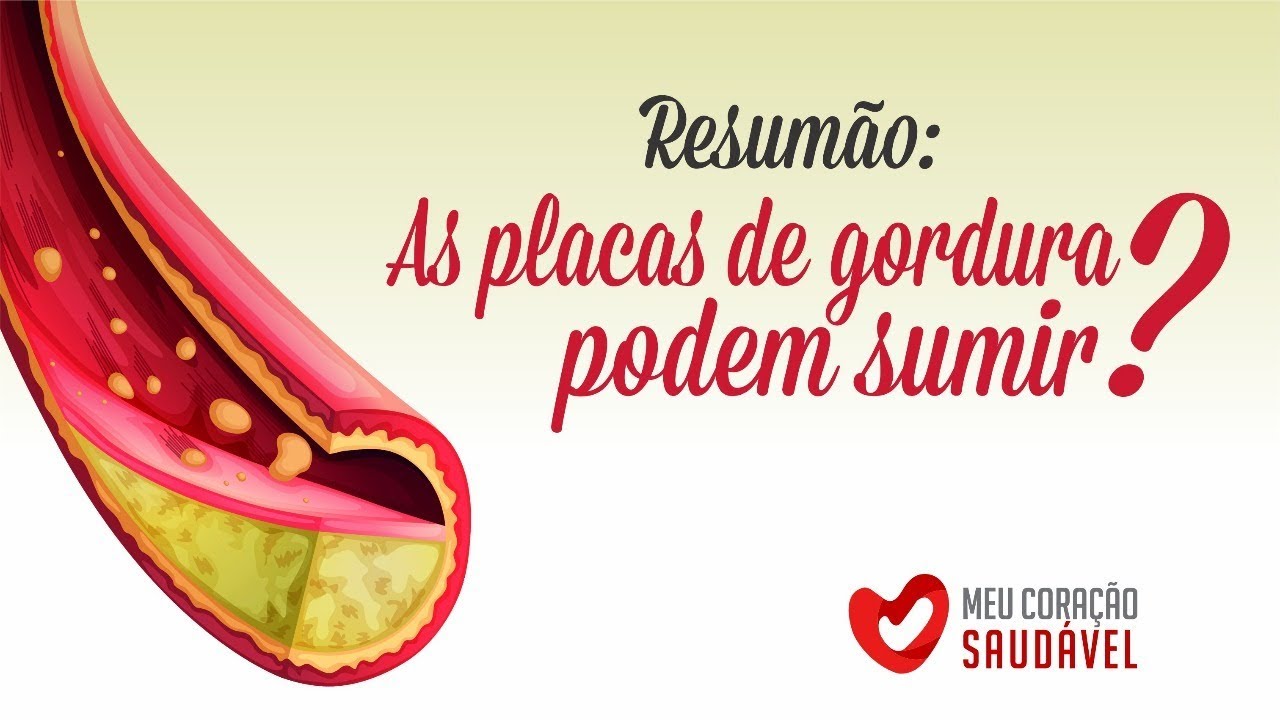 As "placas de gordura" (aterosclerose) podem sumir? Um Resumão