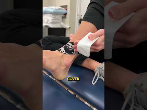 Kinesiology taping for ankle stability technique #kinesiotaping #anklepain #taping #physicaltherapy