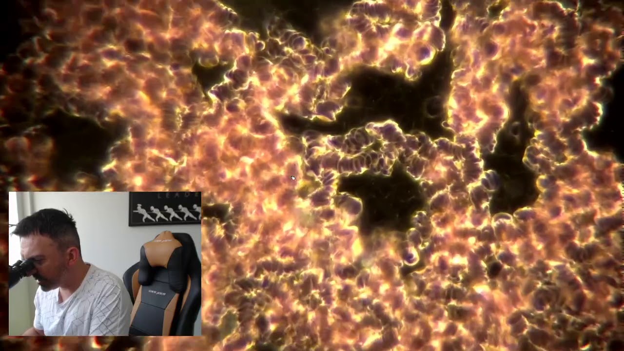 Live Blood Analysis - Sample #1