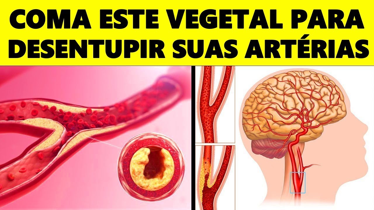 Este é o MELHOR VEGETAL para limpar os vasos sanguíneos