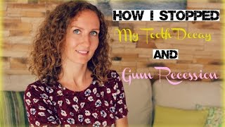 How I Stopped My Tooth Decay and Gum Recession
