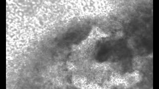 Bright field video of the mouse cardiomyocytes.