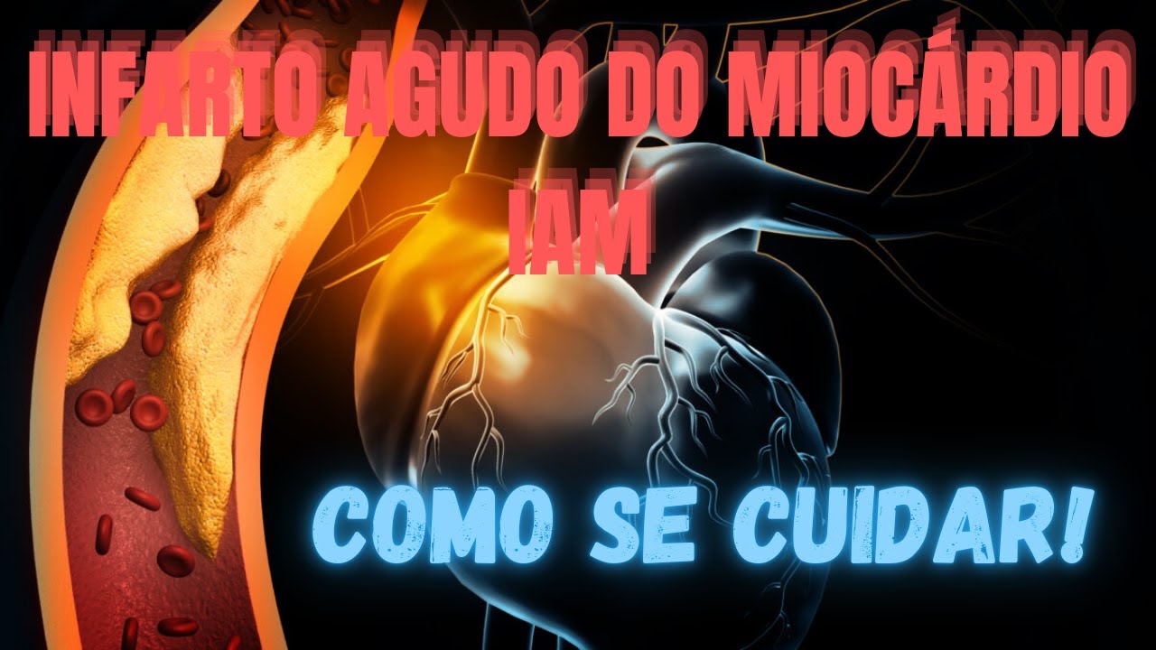 🫀 INFARTO AGUDO DO MIOCÁRDIO: Sintomas, Causas e Tratamentos 🆘
