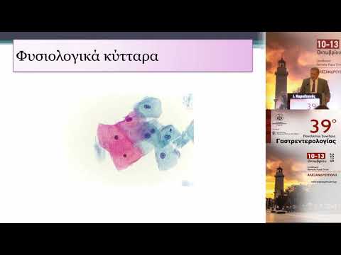 video συνεδρίων on demand