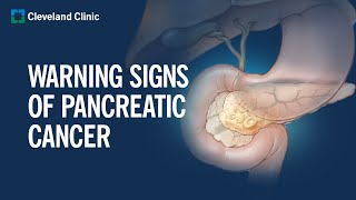 Download lagu 6 Warning Signs of Pancreatic Cancer... mp3