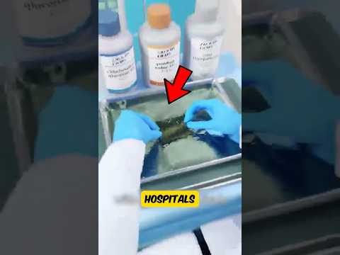 If You Ever Hear About Fish Skin Healing Burns, This Is Why