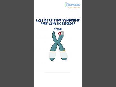 Diagnostics on Demand Cardiac tamponade