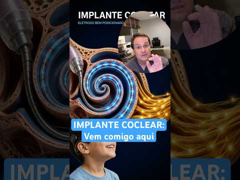 Vídeo sobre implante coclear