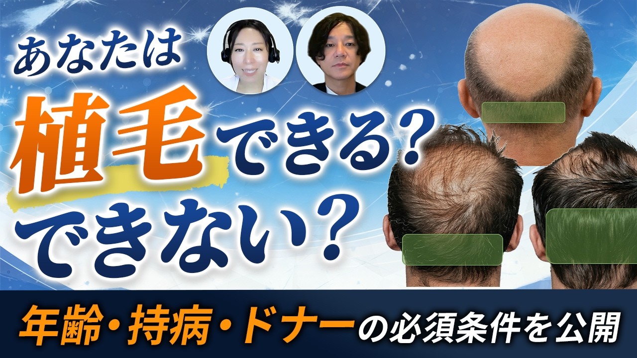 あなたは植毛できる？向いている人・向いていない人を徹底解説