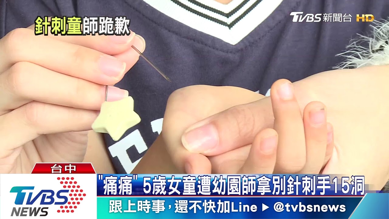 「痛痛」5歲女童遭幼園師拿別針刺手15洞 師下跪