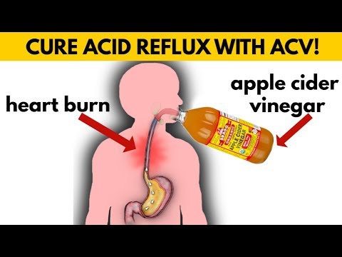 download lagu mp3 mp4 Acv For Acidity, download lagu Acv For Acidity gratis, unduh video klip Acv For Acidity