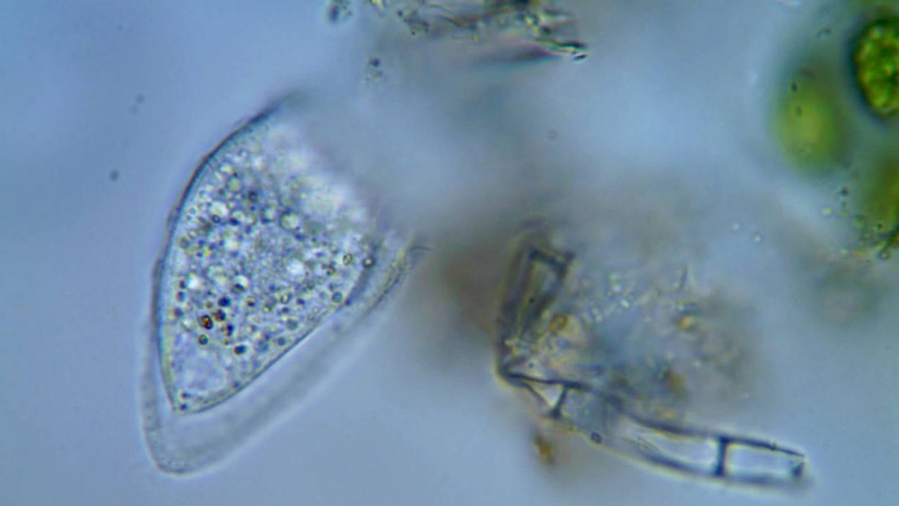 Loxophyllum helus (Stokes, 1884) Penard, 1922