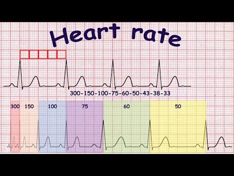 ECG basics: Methods of heart rate calculation