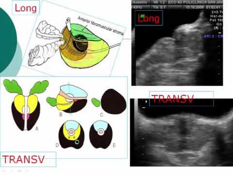 Semi di zucca della prostata Qual è la diagnosi di prostata sosp cr