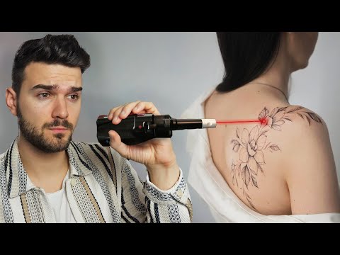 Így tünteti el a LÉZER a tetoválásokat! - Márkopédia #5