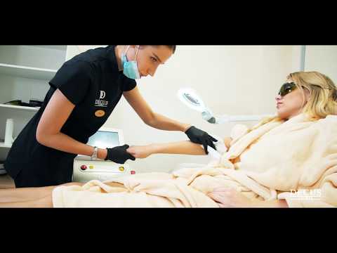 Laser epilation at the Decus Clinic.