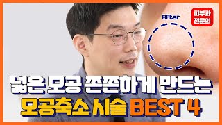 모공축소 시술 총정리! feat. 모공이 커지는 이유 아쿠아필vs실펌엑스vs클라리티vs레티놀
