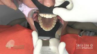 Smile Line by Style Italiano, FlexiPalette