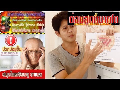 เพิ่มขึ้นแรงเยียวยาพื้นบ้าน ยาสำหรับชาย Sniper ความแข็งแรงทางเพศ