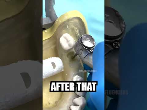 How The Dentist Extracts a Tooth