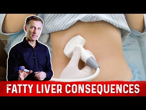 How Your Feet Are Warning You About Your Liver Problems Dr Berg Explains