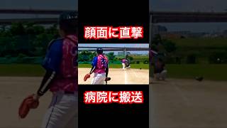 送球×グラブが顔面直撃して救急搬送されました #shorts