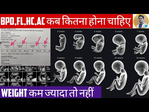 PREGNANCY ULTRASOUND REPORT IN HINDI/BPD/HC/AC/FL/IN PREGNANCY REPORT/ULTRASOUND REPORT IN HINDI