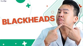 Removing Blackheads: Best & Worst Ways