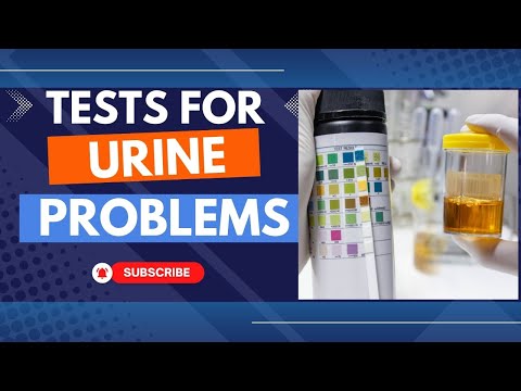 Urine test se kya pata chalta hai Qualitative analysis of urine Urinalysis test