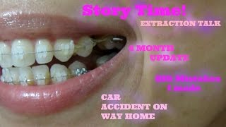 StoryTime: Adult Ceramic Braces Update | Extractions Story =/ - 2 Pt. 1
