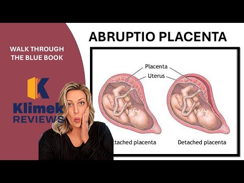 ABRUPTIO PLACENTA + questions with Dr. Sharon