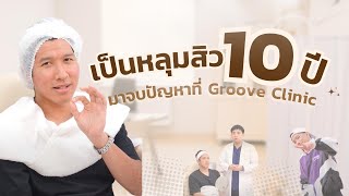 หลุมสิวลึก คุณเติ้ล