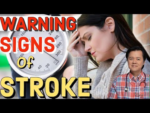 7 Warning Signs of Stroke - By Doc Willie Ong #1099