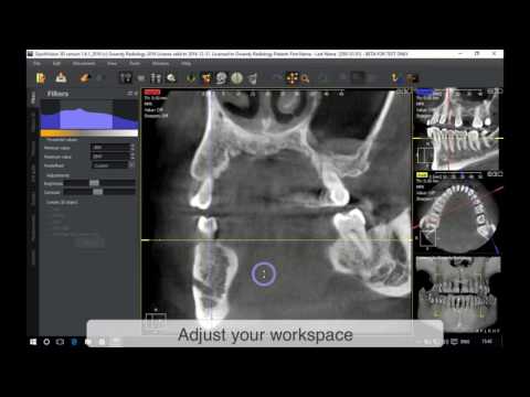 QuickVision 3D - Adjust your workspace - OWANDY RADIOLOGY