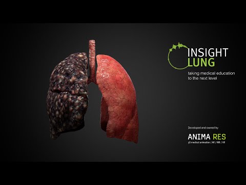 INSIGHT LUNG Video