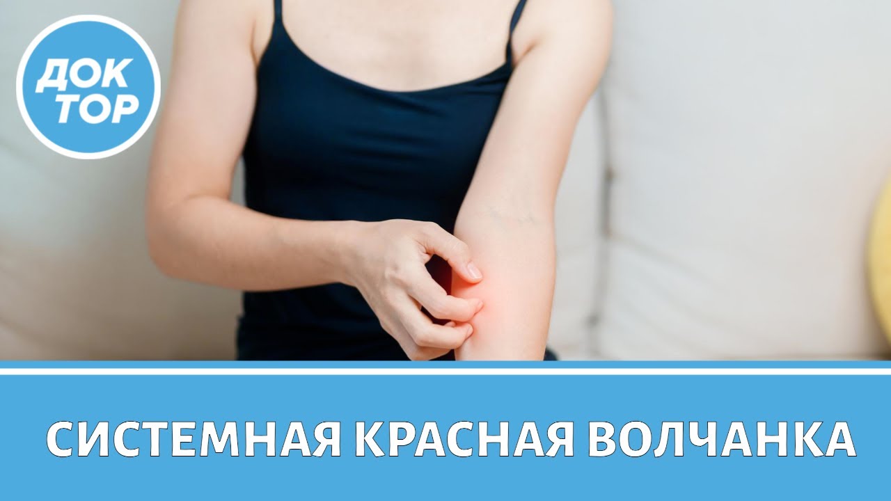 Врач-ревматолог ответил на вопросы о системной красной волчанке