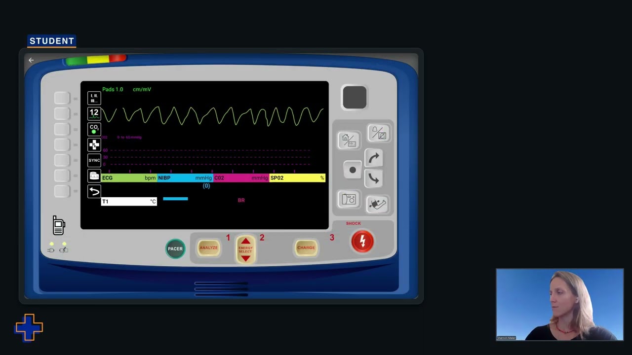 SimVS Hospital Training: ZOLL X Series Deep Dive