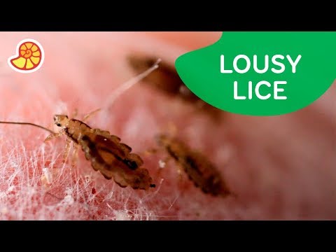 Getting Rid of Lice with a Vacuum Cleaner | Operation Ouch!