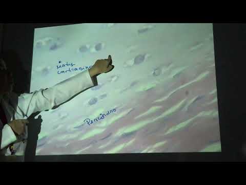 Tecido Cartilaginoso - Traqueia - Amanda