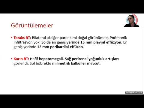 Emek Gerektiren Olgular EGO 29 kasim 2023