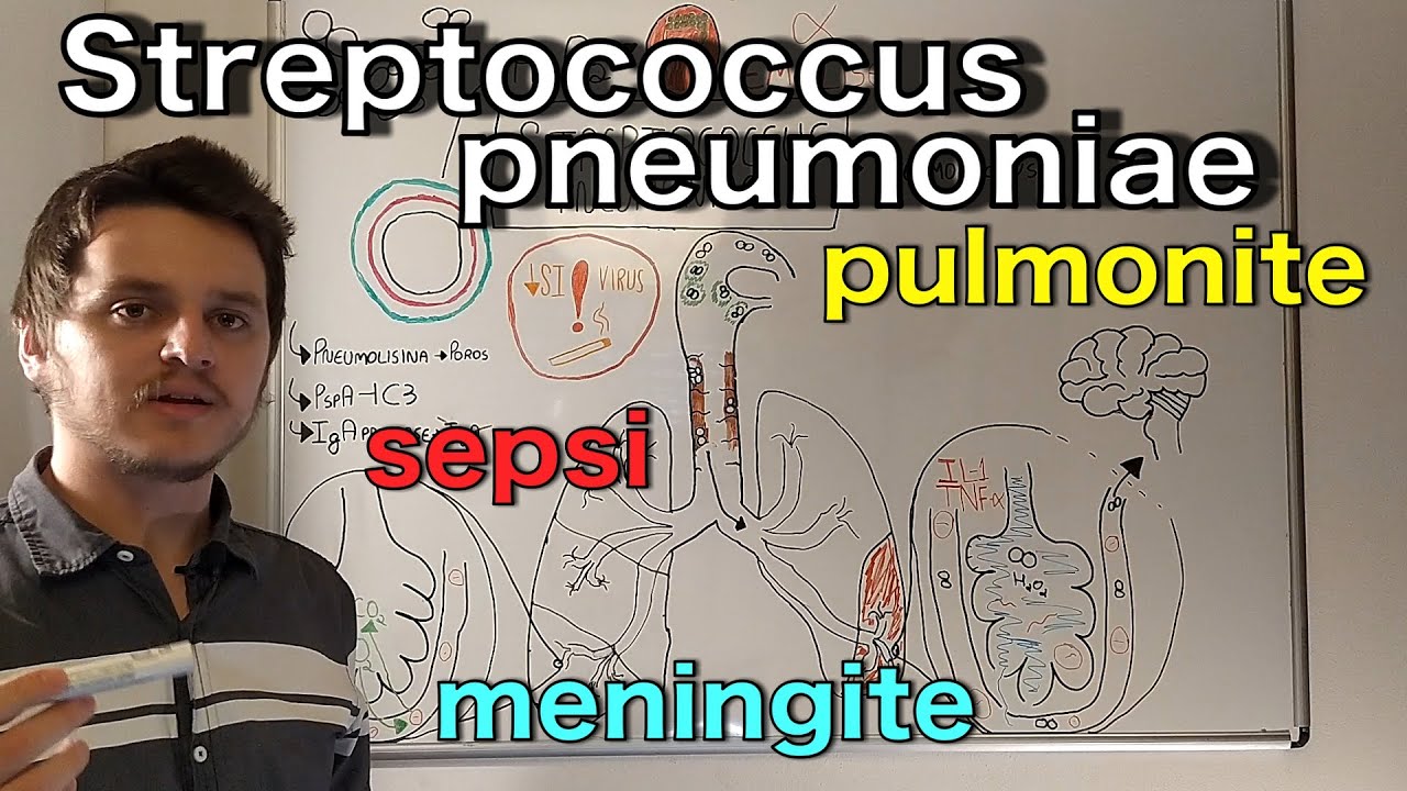 Streptococcus pneumoniae (pneumococco) | Curso de bacteriologia | Medicina passo a passo
