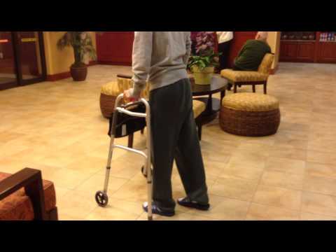 Walking with Precice 2 in femurs post-op day 50