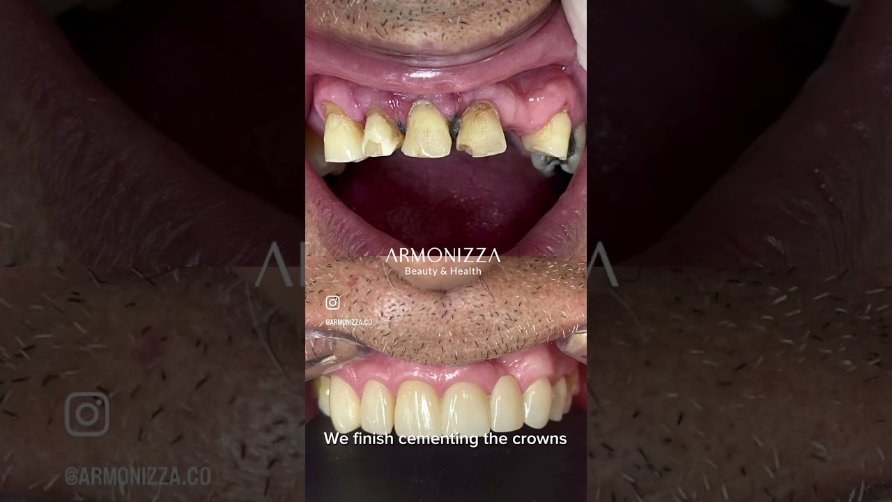 Johanna Sepúlveda-26