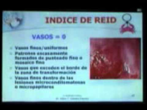 PRIMER CURSO DE COLPOSCOPÍA - INDICE DE REID (2/2)