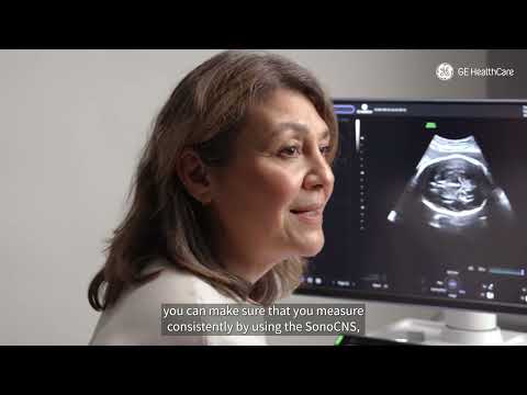 How to reduce the exam time of the fetal brain by up to 82 %? 