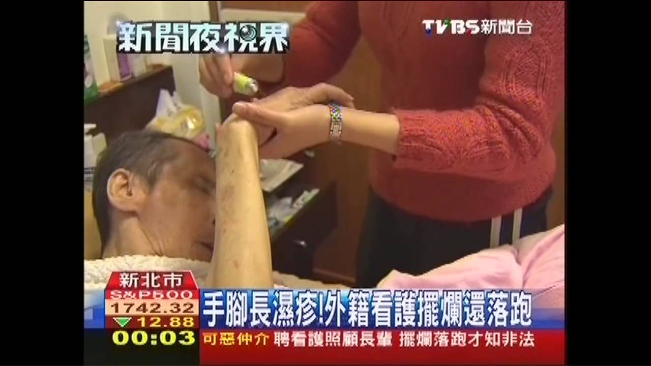手腳長濕疹！　外籍看護擺爛還落跑