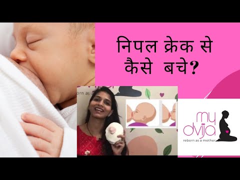 निपल क्रेक से कैसे  बचे? Nipple cracks, pain, soreness - reasons and home remedies
