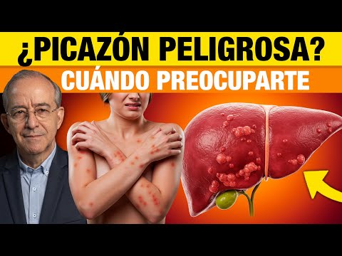 PICAZON PELIGROSA EN EL CUERPO, Cuando Preocuparte? - Oswaldo Restrepo RSC