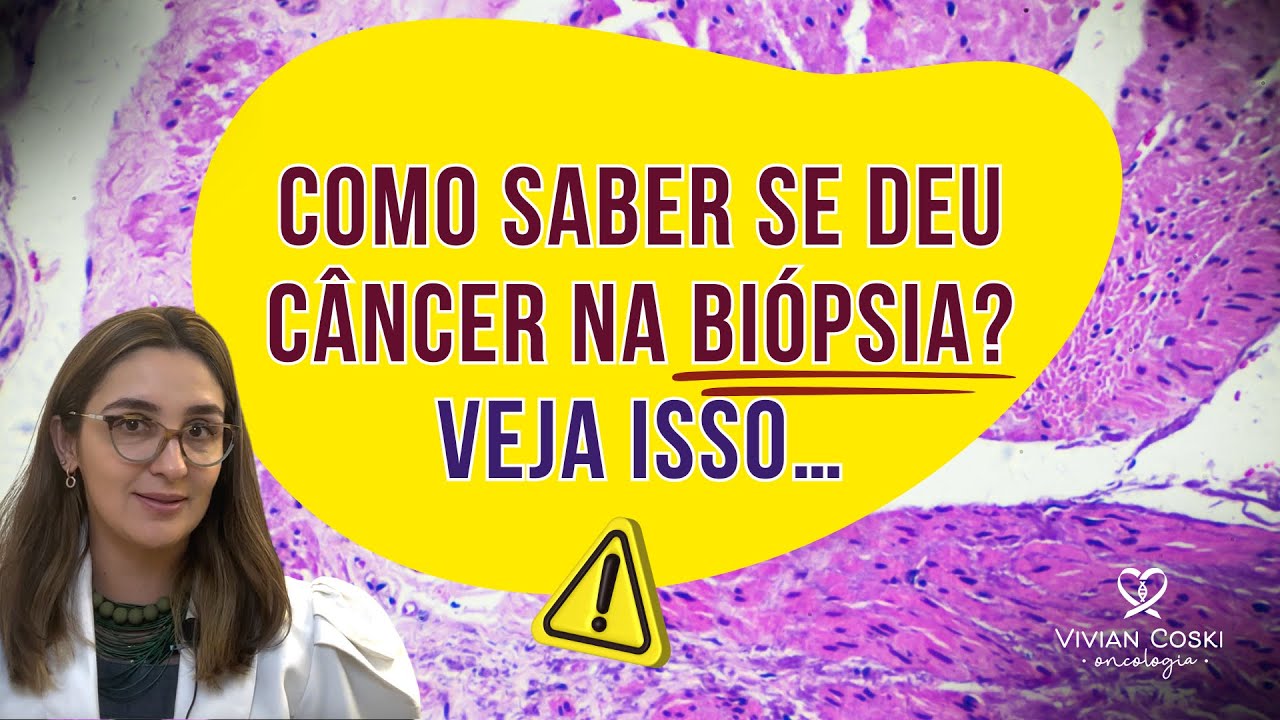 Como ler o resultado de uma biópsia?